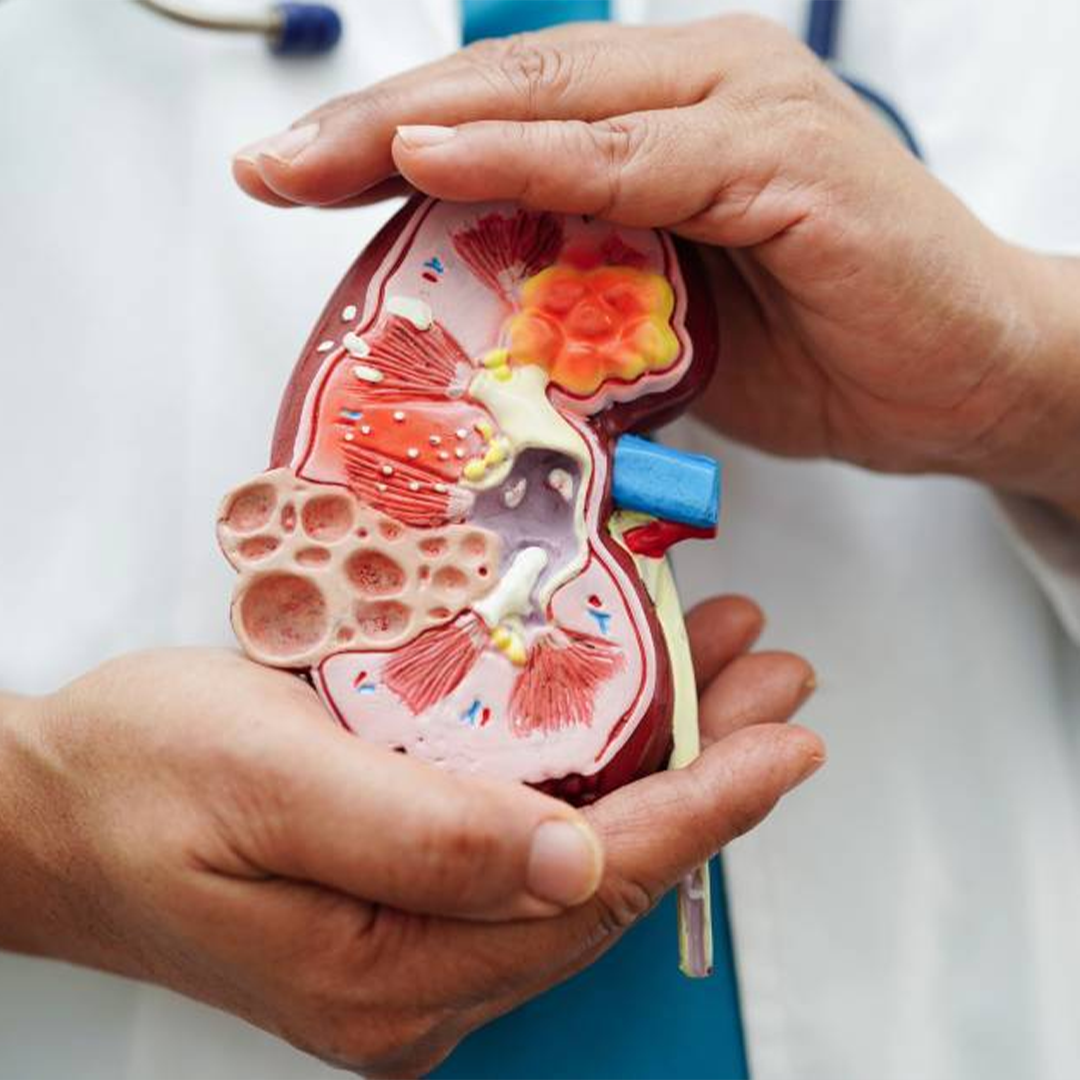 Kidney Consultation with Dr. A. S. M. Julfekar Helal