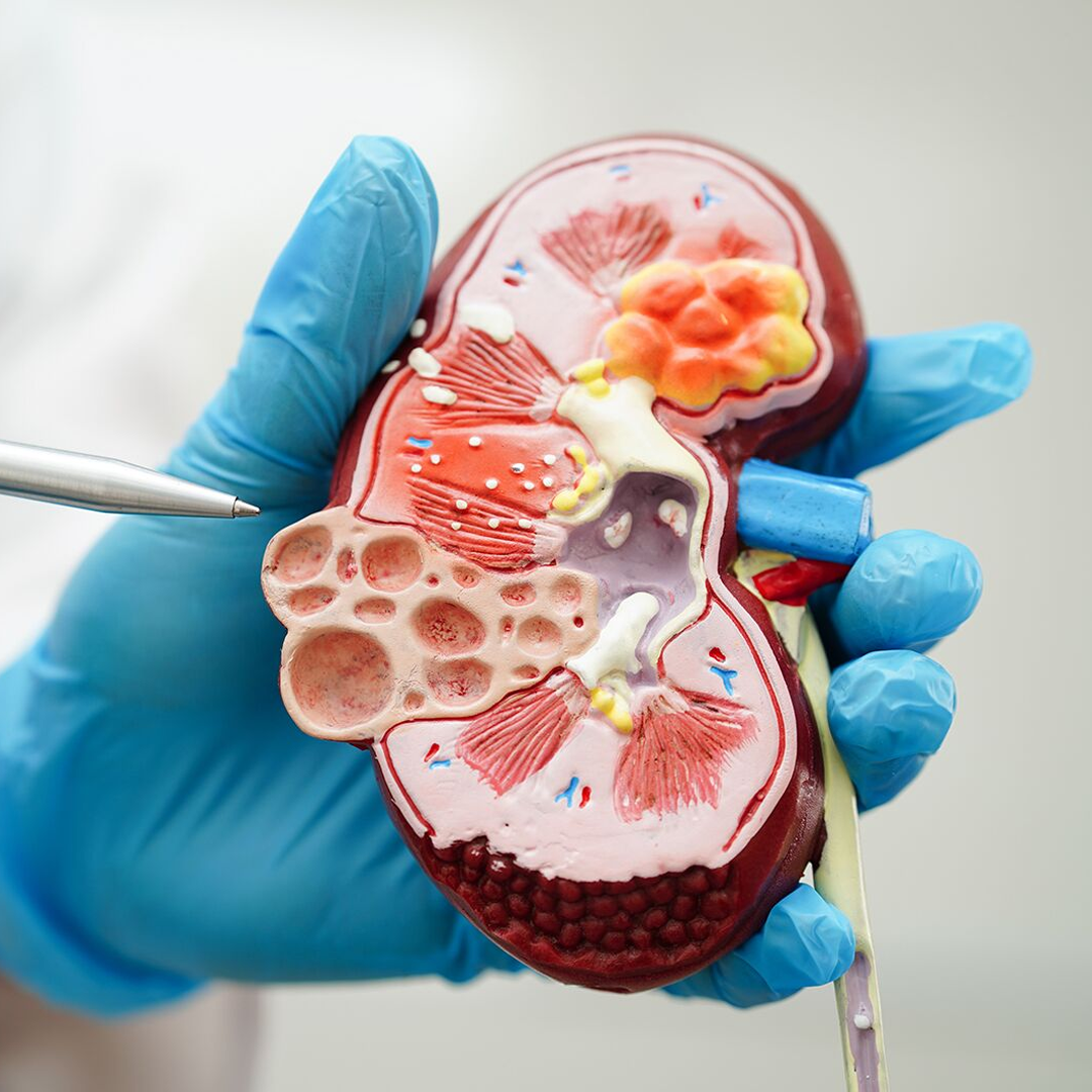 Regular Kidney Health Follow Up