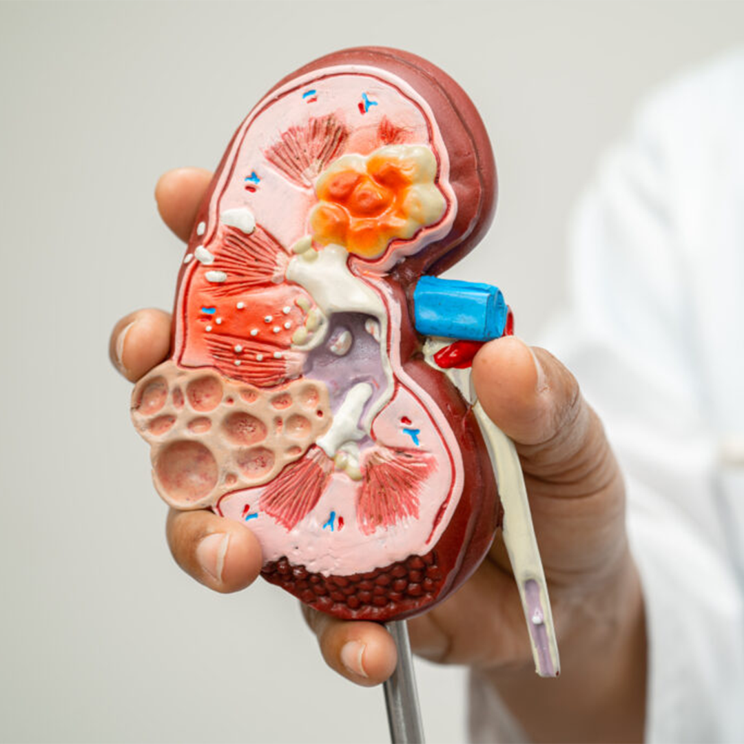Patient Safety and Renal Care Standards