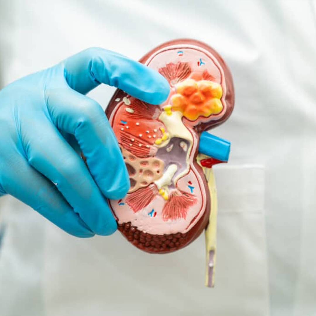 Comprehensive Kidney Disease Treatment